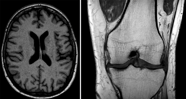 T1 Weighted Imaging